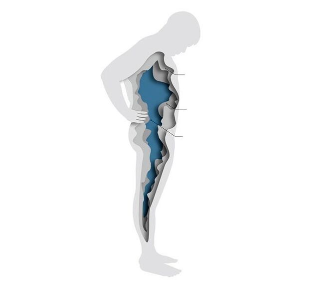 Hormones and overweight